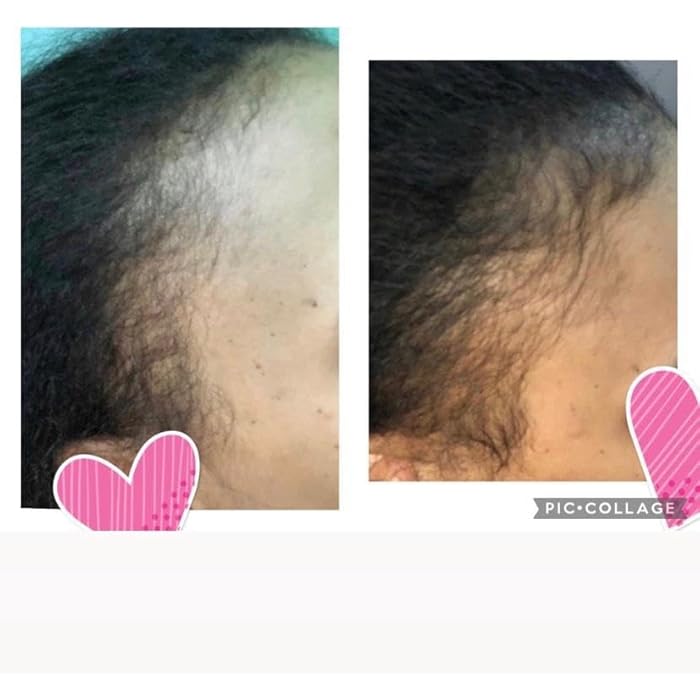 زنك اويل للشعر صحى ناعم وكثيف يحتوى عن اكثر من 7 انواع من الفيتامينات الأساسية للشعر وفروة صحية100 ملي - Image 4